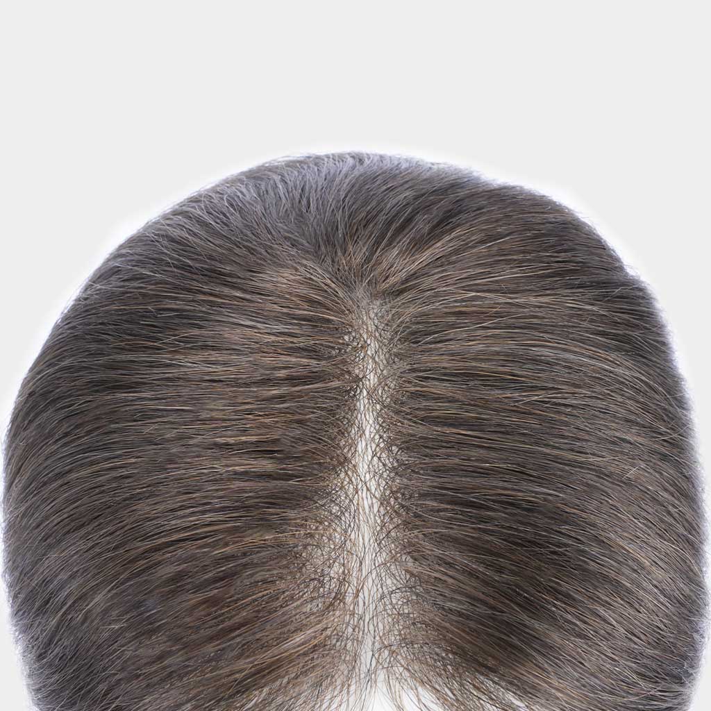 Tide Crown hair system — 0.06mm thin skin crown piece